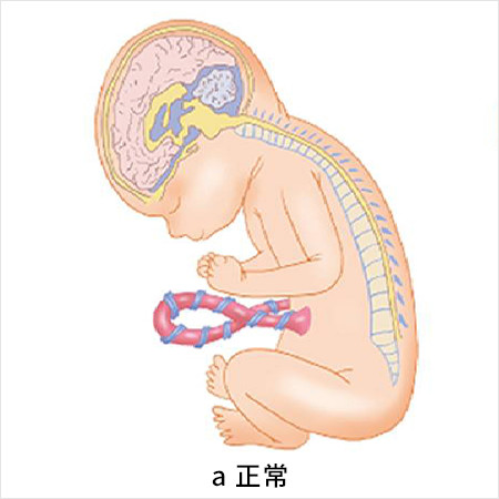 図：正常の胎児