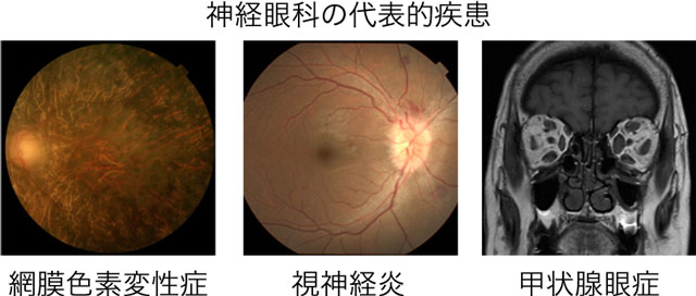 鹿児島大学医学部 眼科学教室