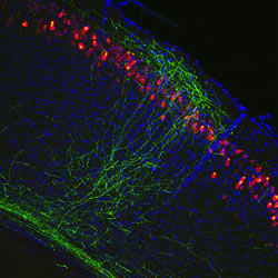 Neural circuits in the cerebral cortex